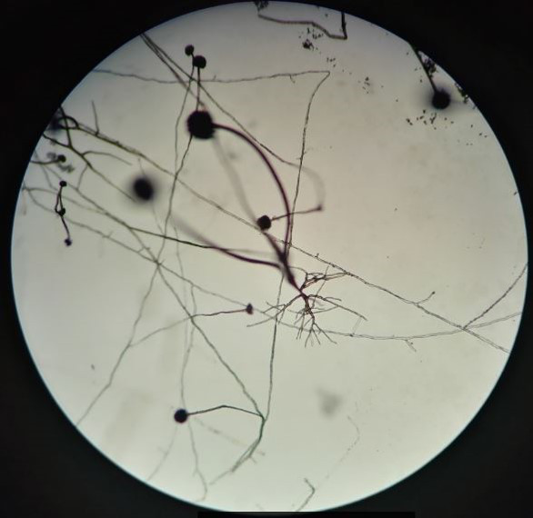 在显微镜下观察到如下结果,这是( )菌的标准切片. [图