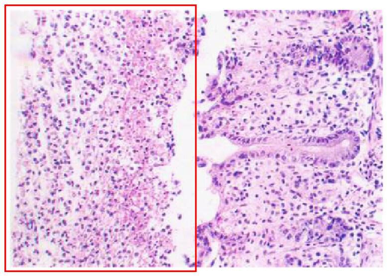 The following figure shows the histological change