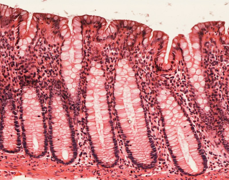 下图为一段消化管管壁的黏膜层，仔细观察结构，判断这段消化管的名称。 