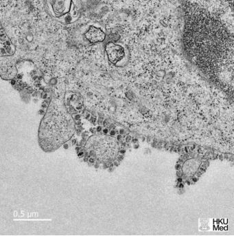 图片为冠状病毒感染组织细胞内图片，该图片使用的显示方法是：