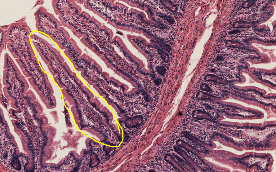 小肠是主要的消化和吸收场所，小肠壁上有些结构的存在可以显著增加小肠表面与食物的接触面积。下图中可见其