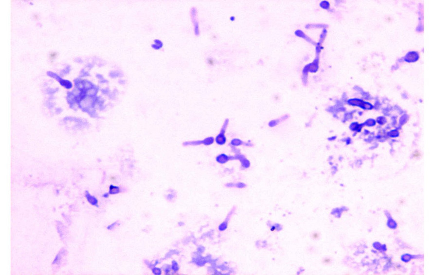 指出下图经特殊染色法染色镜检所见的细菌特殊结构是