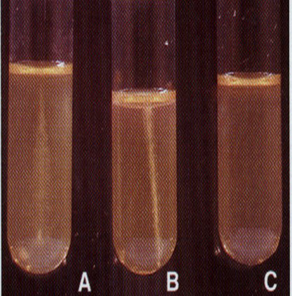将细菌穿刺接种于半固体培养基，结果见下图，可用于测试不同种类细菌有无特殊结构——，其中具有该结构的细