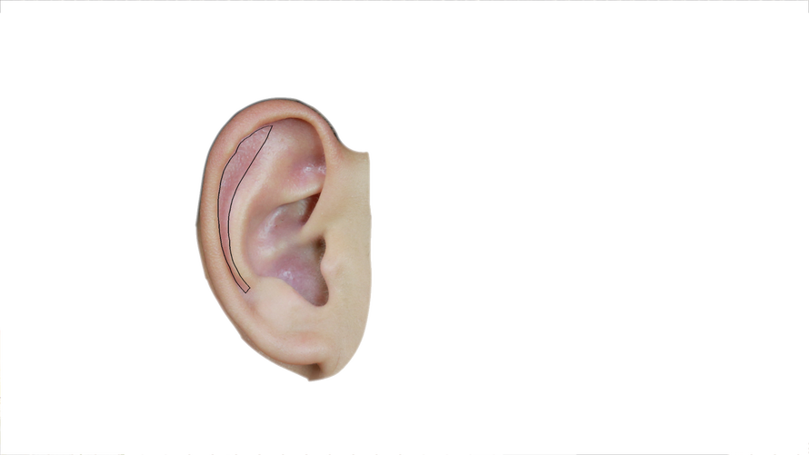 根据耳穴分布规律，面颊部对应的耳穴分布在