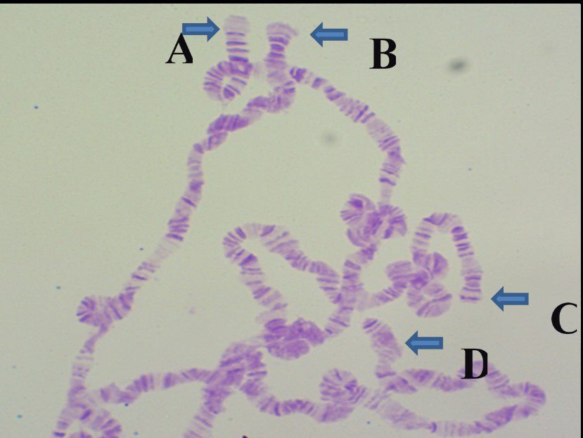 下图中哪个是黑腹果蝇第三染色体左臂端部？
