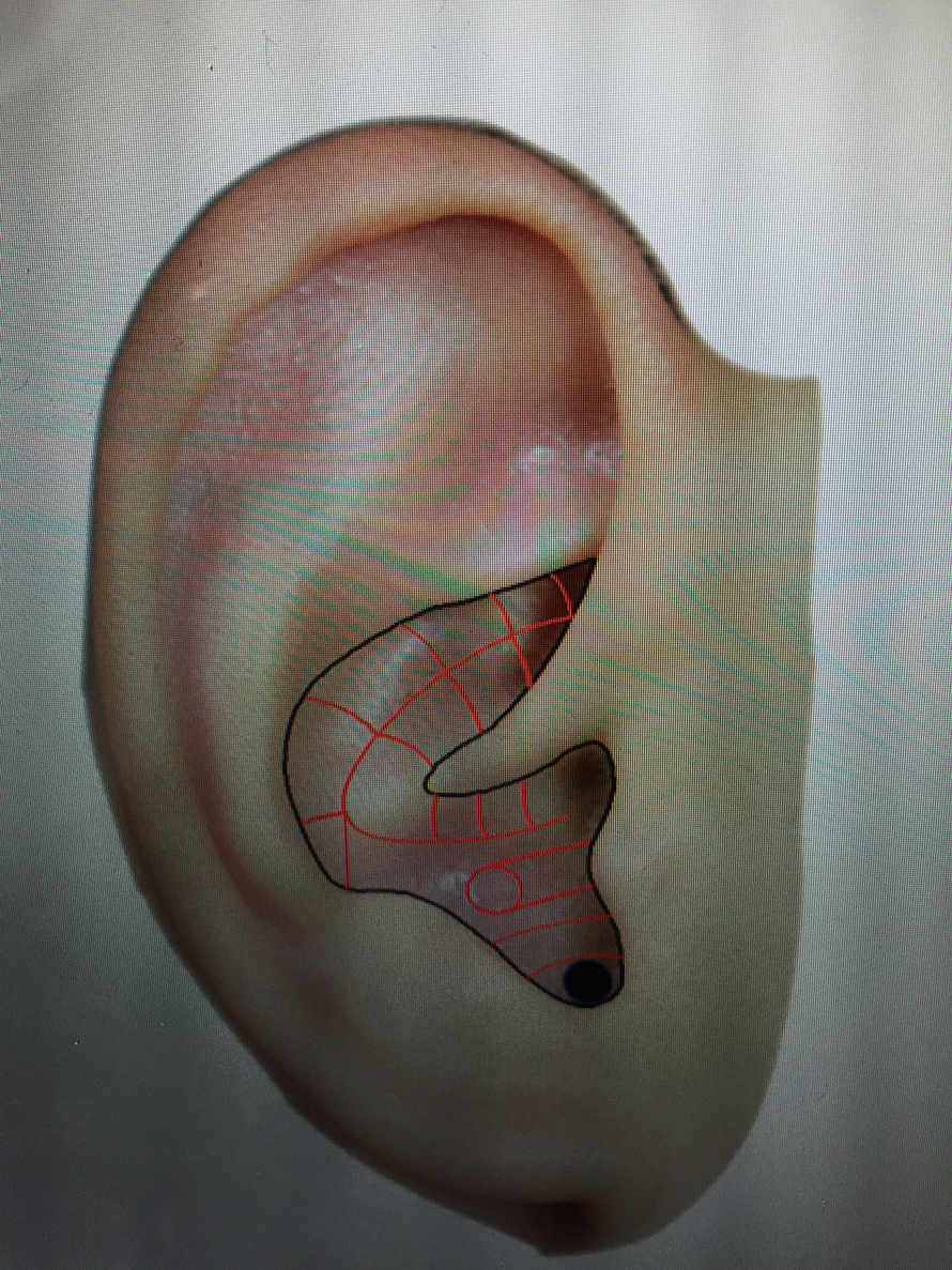 下图中黑色圆点标示的耳穴是 