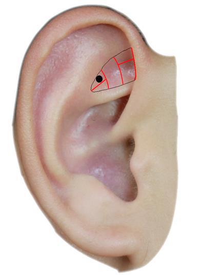 下图黑色圆点标示的耳穴具有镇静安神的作用，其名称是 
