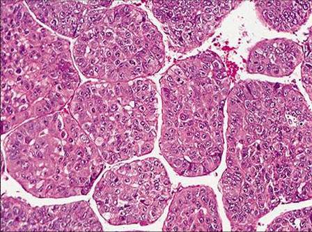 Which of the following histologic section is cirrh