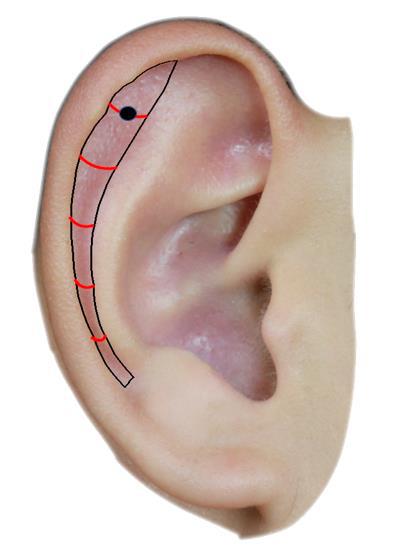 下图标示黑点的穴位擅于治疗各种过敏性疾病，其耳穴名称是 