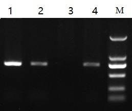 你认为图中（）泳道的PCR结果最好。 