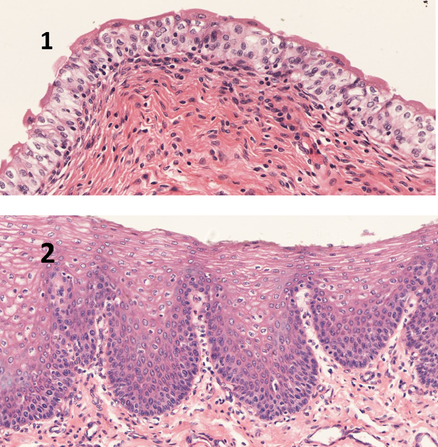 膀胱内表面的上皮是().a. 单层柱状上皮b. 变移上皮c.