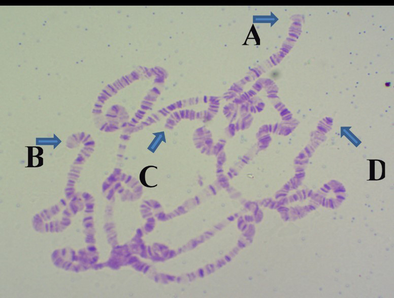 下图中哪个是黑腹果蝇第三染色体左臂端部?[图]a,ab,bc