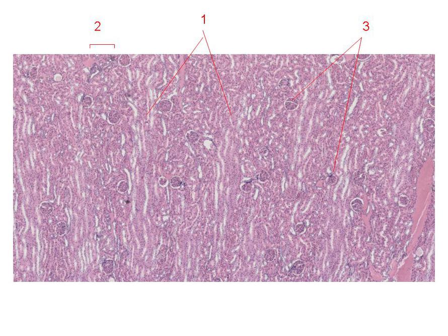 肾皮质迷路光镜图图片