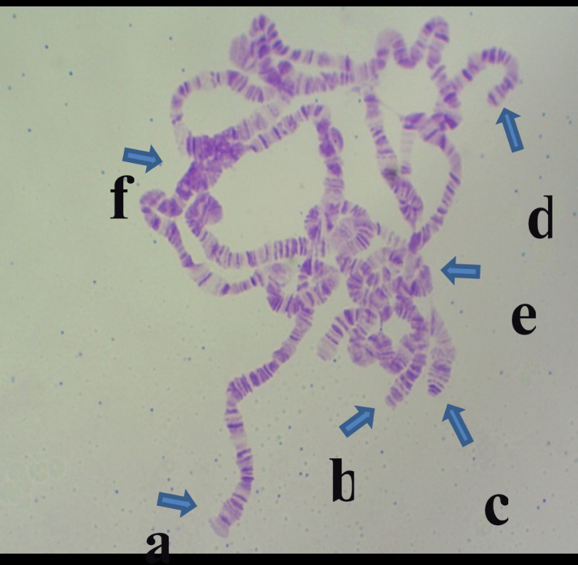 下图中哪个是黑腹果蝇第三染色体左臂端部?[图]a,ab,bc