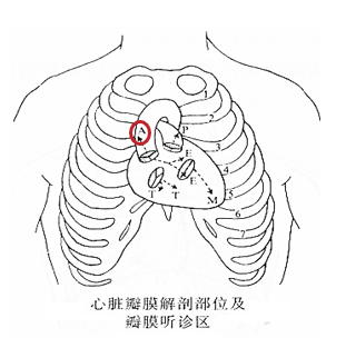 心脏听诊位置图图片