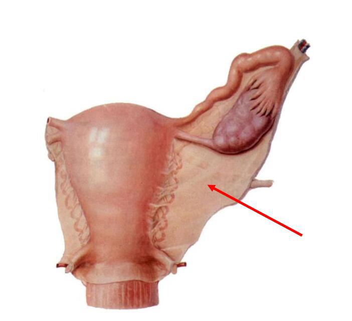 图此为子宫阔韧带