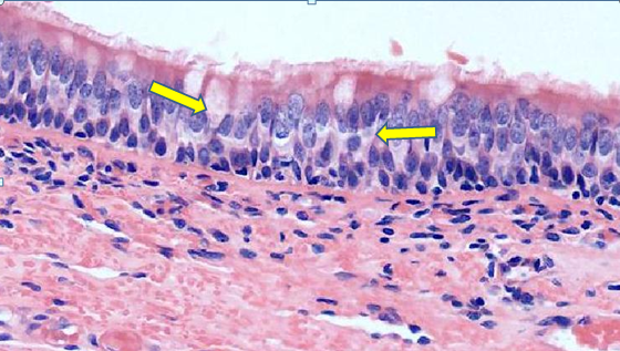 胃肠上皮中都有杯状细胞.()_简答题试题答案